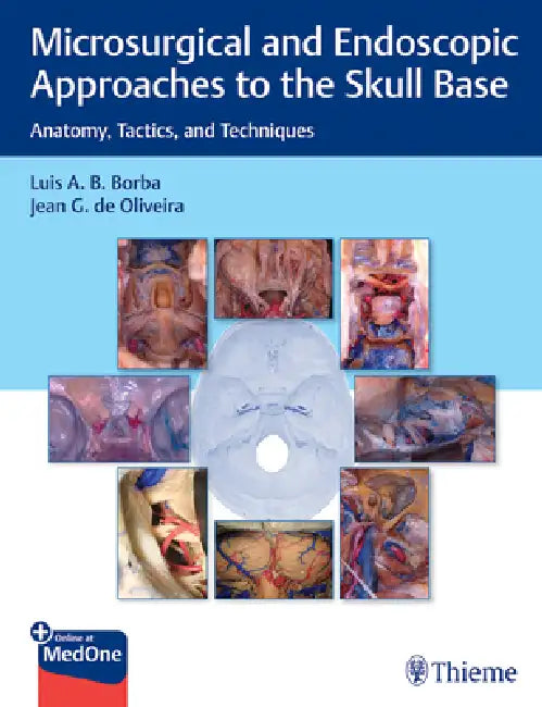 Buy Microsurgical and Endoscopic Approaches to the Skull Base (English, Luis Borba | Jean de Oliveira) — BookShops.in