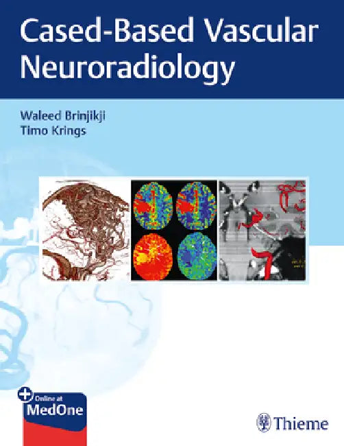 Buy Imaging in Neurovascular Disease (English, Waleed Brinjikji | Timo Krings) — BookShops.in