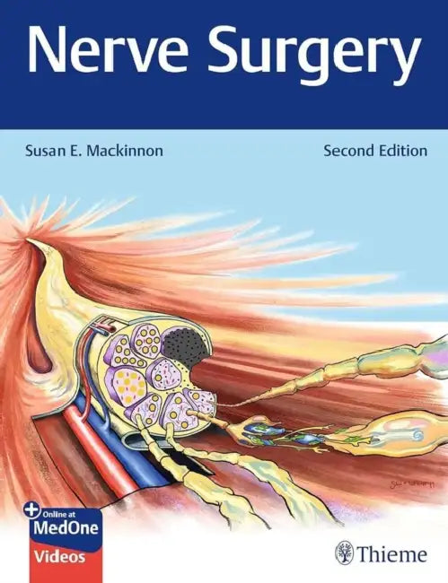 Buy Nerve Surgery (English, Susan E. MacKinnon) — BookShops.in