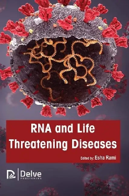 Buy RNA and Life Threatening Diseases (English, Esha Rami) — BookShops.in