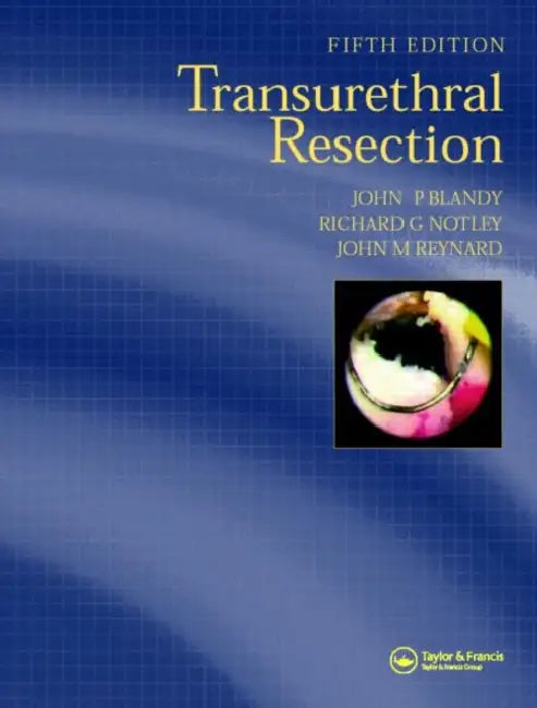 Buy (Ex)Transurethral Resection (English, Blandy) — BookShops.in