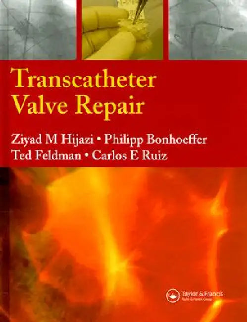 Buy Transcatheter Valve Repair (English, Ziyad M. Hijazi | Carlos E. Ruiz | Philipp Bonhoeffer) — BookShops.in