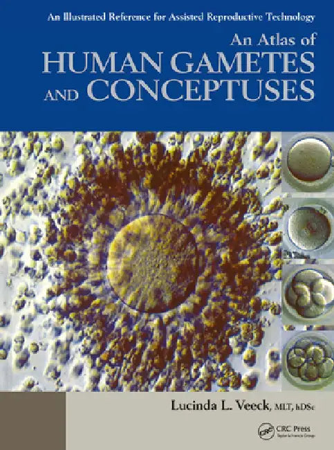 Buy An Atlas of Human Gametes and Conceptuses (English, Lucinda L. Veeck) — BookShops.in