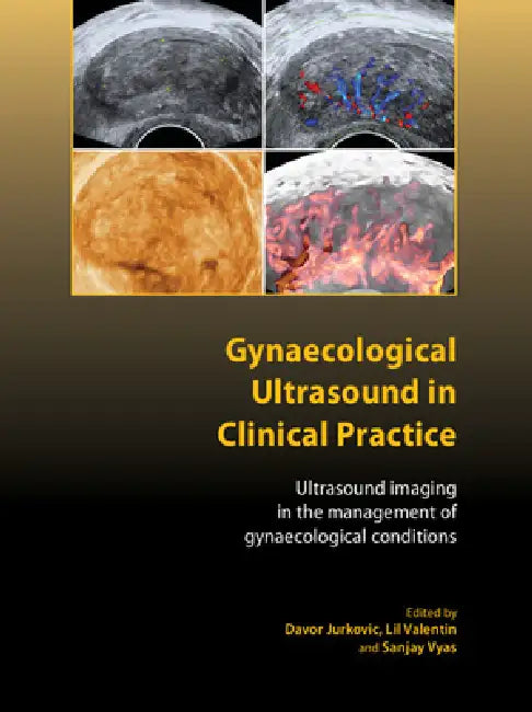 Buy Gynaecological Ultrasound in Clinical Practice | by Davor Ju — BookShops.in