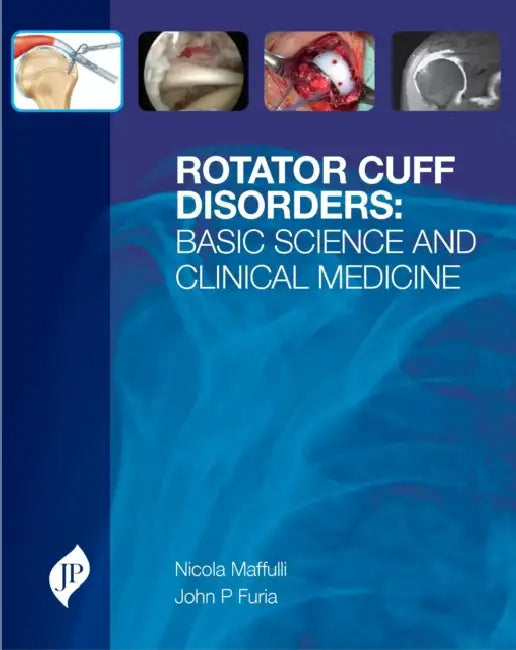 Buy Rotator Cuff Disorders (English, Nicola Maffulli) — BookShops.in
