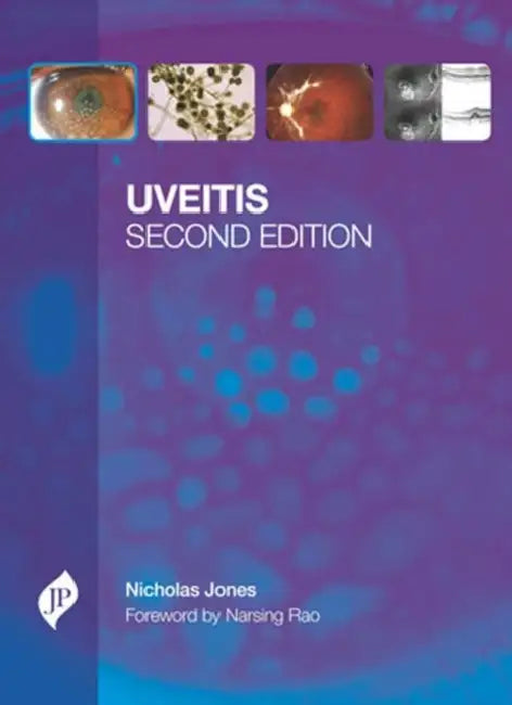 Buy Uveitis With Cd-Rom (English, Nicholas Jones) — BookShops.in
