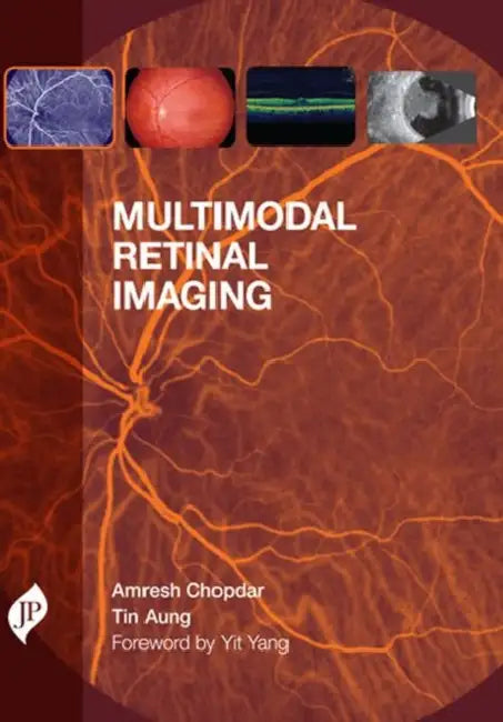 Buy Multimodal Retinal Imaging (English, Amresh Chopdar) — BookShops.in