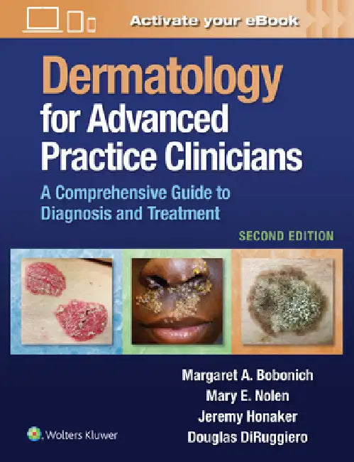 Buy Dermatology for Advanced Practice Clinicians (English, Margaret Bobonich | Mary Nolen | Jeremy Honaker) — BookShops.in