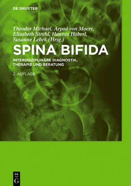 Buy Spina Bifida (English, Theodor Michael) β BookShops.in