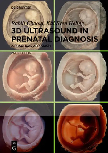 Buy 3D Ultrasound in Prenatal Diagnosis (English, Rabih Chaoui) — BookShops.in