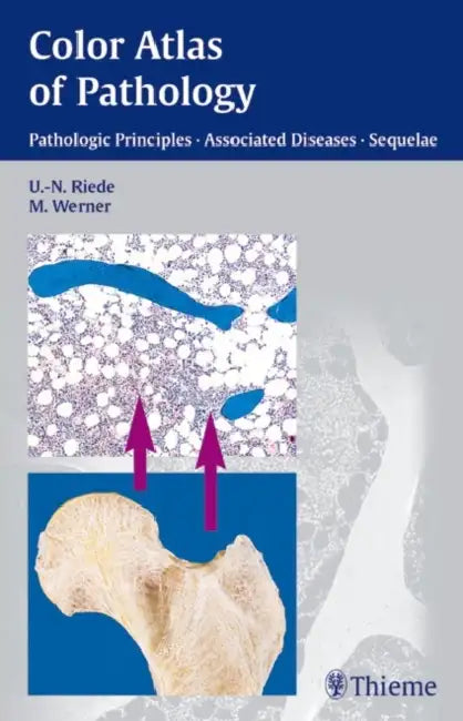 Buy Color Atlas Of Pathology | by Riede | Martin Werner | Thieme Medical Publishers | by Riede | Martin Werner | Thieme Medical Publishers | by Riede | Martin Werner | Thieme Medical Publishers | by Riede | Martin Werner | Thieme Medical Publishers | by Riede | Martin Werner | Thieme Medical Publishers | by Riede | Martin Werner | Thieme Medical Publishers | by Riede | Martin Werner | Thieme Medical Publishers | by Riede | Martin Werner | Thieme Medical Publishers | by Riede | Martin Werner | Thieme — BookShops.in
