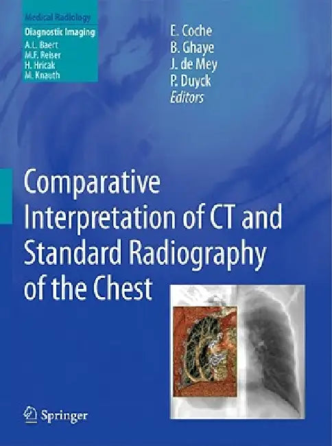 Buy Comparative Interpretation of CT and Standard Radiography of the Chest (English, Emmanuel E. Coche | Benoit Ghaye | Johan De Mey) — BookShops.in