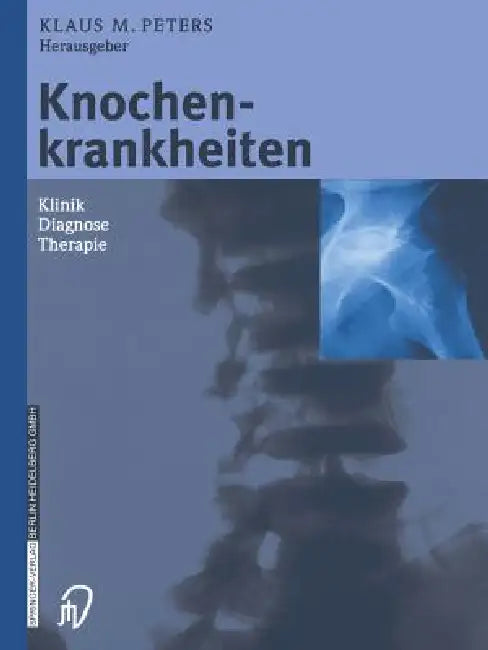Buy Knochenkrankheiten (English, Klaus M. Peters | P. Eysel) — BookShops.in