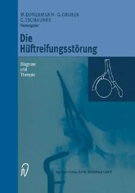 Buy Die Hüftreifungsstörung (English, Werner Konermann | Gerd Gruber | Christian Tschauner) — BookShops.in