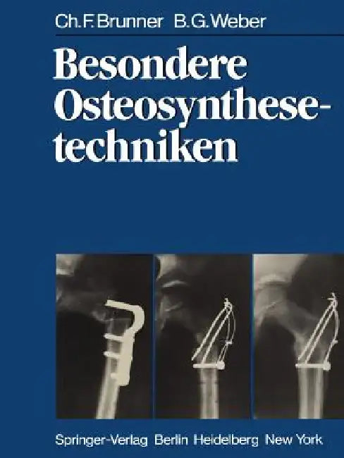 Buy Besondere Osteosynthesetechniken | by C. F. Brunner | B. G.  — BookShops.in