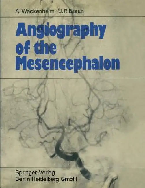 Buy Angiography of the Mesencephalon (English, Auguste Wackenheim | Jean Paul Braun) — BookShops.in