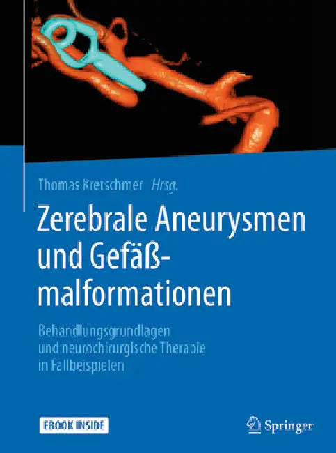 Buy Zerebrale Aneurysmen Und Gefäßmalformationen (English, Thomas Kretschmer) — BookShops.in