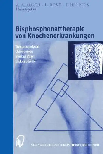 Buy Bisphosphonattherapie Von Knochenerkrankungen (English, A. A. Kurth | L. Hovy | T. Hennigs) — BookShops.in