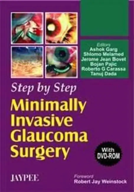 Buy Step By Step Minimally Invasive Glaucoma Surgery With Dvd-Ro — BookShops.in