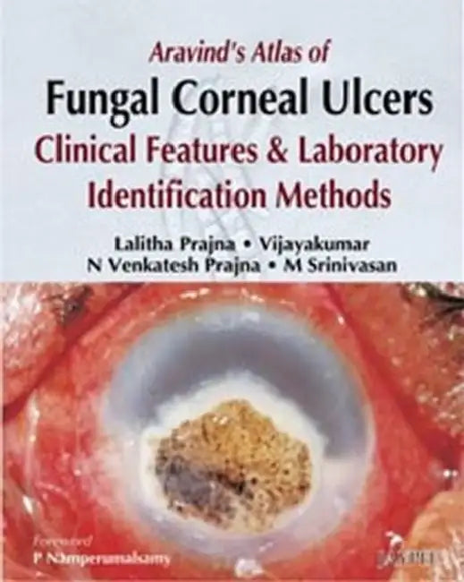 Buy Aravind's Atlas Of Fungal Corneal Ulcers Clinical Features & Lab.Identification Methods | by Lalitha Prajna | Jaypee Brothers Medical Publishers | by Lalitha Prajna | Jaypee Brothers Medical Publishers | by Lalitha Prajna | Jaypee Brothers Medical Publishers | by Lalitha Prajna | Jaypee Brothers Medical Publishers | by Lalitha Prajna | Jaypee Brothers Medical Publishers | by Lalitha Prajna | Jaypee Brothers Medical Publishers | by Lalitha Prajna | Jaypee Brothers Medical Publishers | by Lalitha — BookShops.in