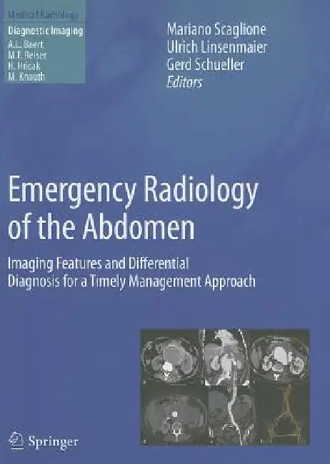 Buy Emergency Radiology of the Abdomen | by Mariano Scaglione | Ulrich Linsenmaier | Gerd Schueller | Springer | by Mariano Scaglione | Ulrich Linsenmaier | Gerd Schueller | Springer | by Mariano Scaglione | Ulrich Linsenmaier | Gerd Schueller | Springer | by Mariano Scaglione | Ulrich Linsenmaier | Gerd Schueller | Springer | by Mariano Scaglione | Ulrich Linsenmaier | Gerd Schueller | Springer | by Mariano Scaglione | Ulrich Linsenmaier | Gerd Schueller | Springer | by Mariano Scaglione | Ulrich L — BookShops.in