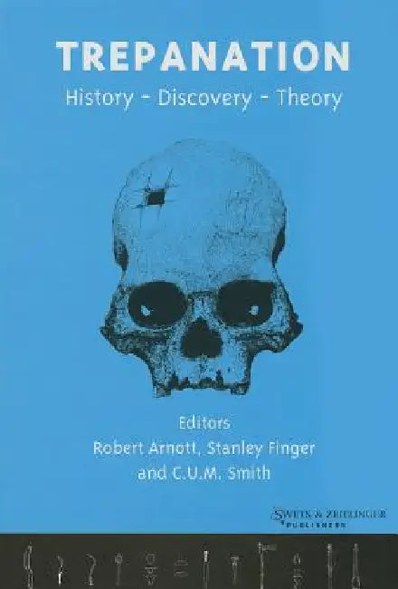 Buy Trepanation (English, Robert Arnott | Stanley Finger | Chris Smith) — BookShops.in