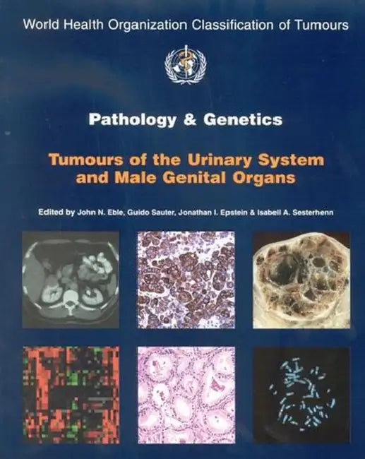 Buy Pathology & Genetics Tumours Of The Urinary System And Male Genital Organs Who Classification Of Tum | by Eble | World Health Organization | by Eble | World Health Organization | by Eble | World Health Organization | by Eble | World Health Organization | by Eble | World Health Organization | by Eble | World Health Organization | by Eble | World Health Organization | by Eble | World Health Organization | by Eble | World Health Organization | by Eble | World Health Organization | by Eble | World H — BookShops.in