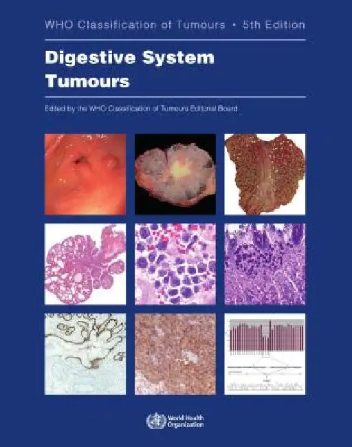 Buy Digestive System Tumours (English, Who Classification of Tumours Editorial) — BookShops.in