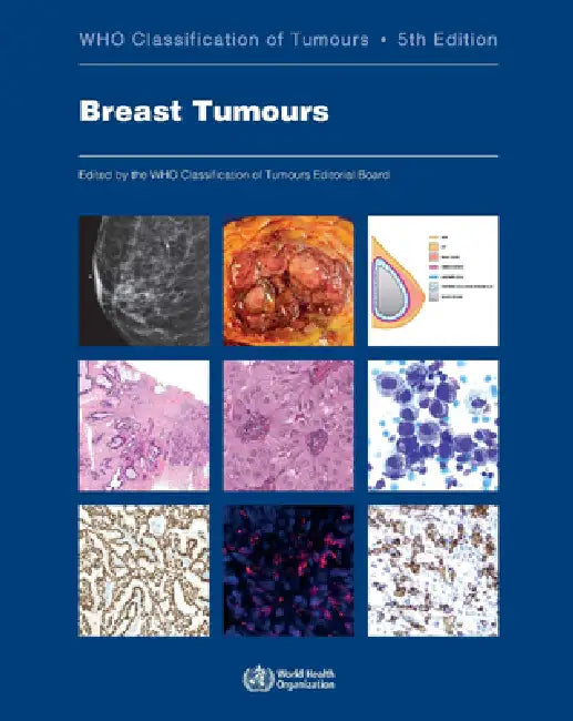 Buy Breast Tumours (English, Who Classification of Tumours Editorial) — BookShops.in