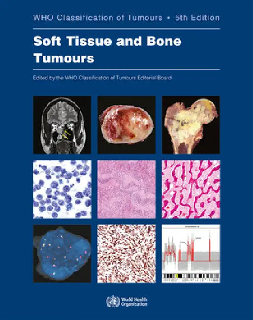 Buy Soft Tissue and Bone Tumours (English, Who Classification of Tumours Editorial) — BookShops.in