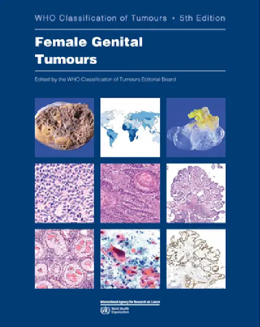 Buy Female Genital Tumours (English, Who Classification of Tumours Editorial) — BookShops.in