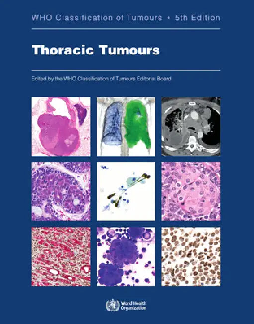 Buy Thoracic Tumours (English, Who Classification of Tumours Editorial) — BookShops.in