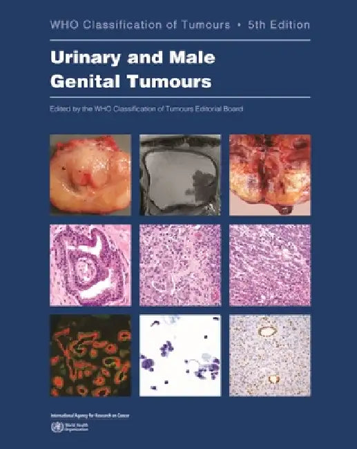 Buy Urinary and Male Genital Tumours (English, Who Classification of Tumours Editorial) — BookShops.in