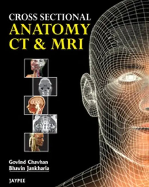 Cross Sectional Anatomy Ct And Mri | by Govind B Chavhan | Jaypee Brothers Medical Publishers | by Govind B Chavhan | Jaypee Brothers Medical Publishers | by Govind B Chavhan | Jaypee Brothers Medical Publishers | by Govind B Chavhan | Jaypee Brothers Medical Publishers | by Govind B Chavhan | Jaypee Brothers Medical Publishers | by Govind B Chavhan | Jaypee Brothers Medical Publishers | by Govind B Chavhan | Jaypee Brothers Medical Publishers | by Govind B Chavhan | Jaypee Brothers Medical Publ