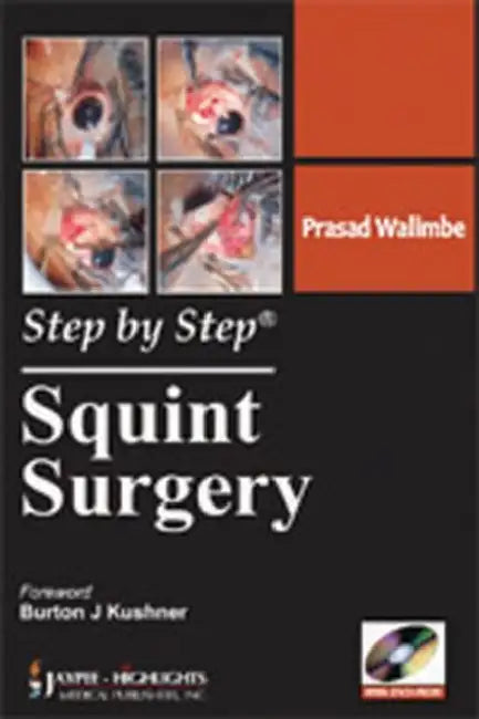 Buy Step By Step Squint Surgery (English, Prasad Walimbe) — BookShops.in