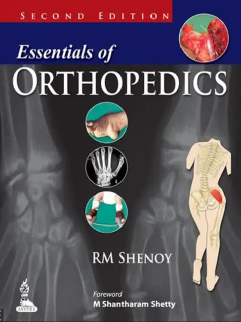 Buy Essentials Of Orthopedics (English, RM Shenoy) — BookShops.in