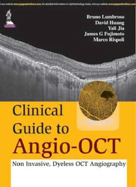 Buy Clinical Guide To Angio-Oct (English, Bruno Lumbroso) — BookShops.in