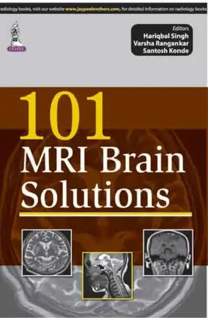 Buy 101 Mri Brain Solutions (English, Hariqbal Singh) — BookShops.in