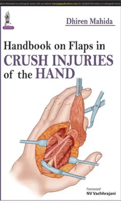 Buy Handbook On Flaps In Crush Injuries Of The Hand (English, Dhiren Mahida) — BookShops.in