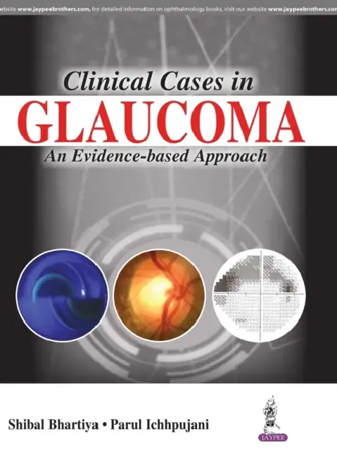 Buy Clinical Cases In Glaucoma An Evidence-Based Approach (English, Shibal Bhartiya) — BookShops.in