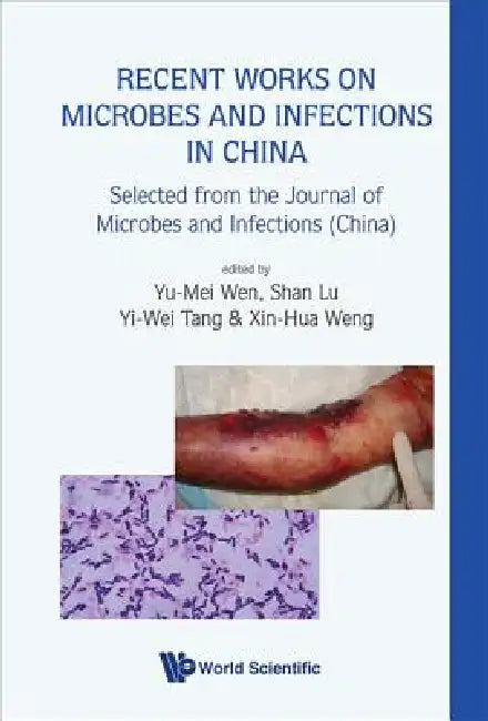 Buy Recent Works on Microbes & Infections... (English, Wen Yu-Mei) — BookShops.in